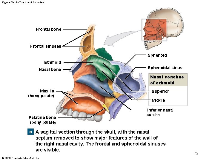 Figure 7– 15 a The Nasal Complex. Frontal bone Frontal sinuses Sphenoid Ethmoid Nasal