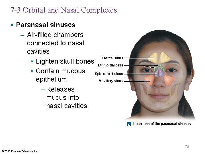 7 -3 Orbital and Nasal Complexes § Paranasal sinuses – Air-filled chambers connected to