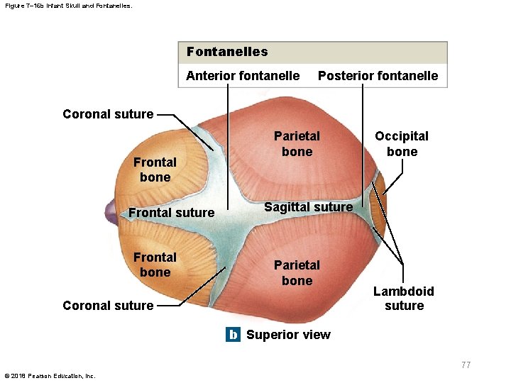 Figure 7– 16 b Infant Skull and Fontanelles Anterior fontanelle Posterior fontanelle Coronal suture