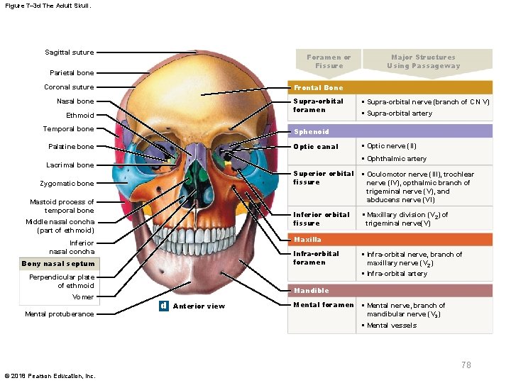 Figure 7– 3 d The Adult Skull. Sagittal suture Foramen or Fissure Parietal bone