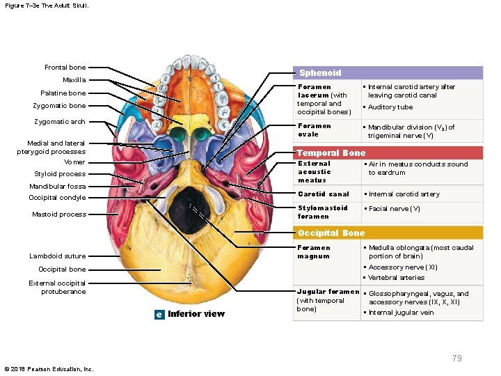 Figure 7– 3 e The Adult Skull. Frontal bone Sphenoid Maxilla Palatine bone Zygomatic