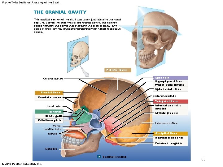 Figure 7– 4 a Sectional Anatomy of the Skull. THE CRANIAL CAVITY This sagittal