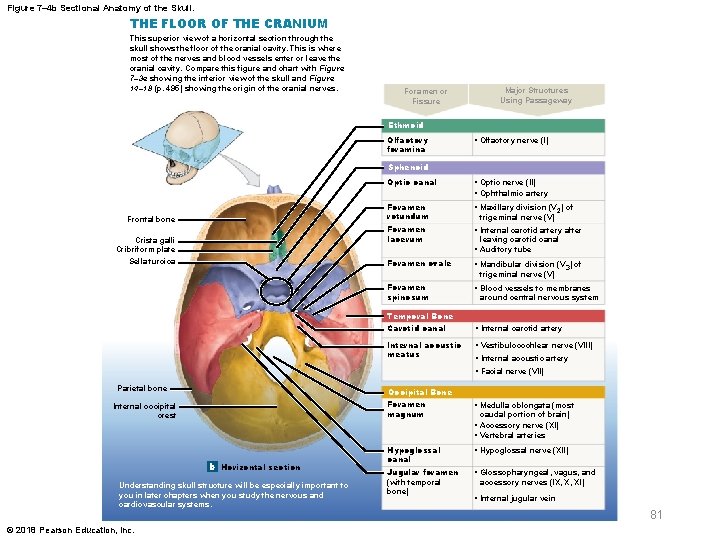 Figure 7– 4 b Sectional Anatomy of the Skull. THE FLOOR OF THE CRANIUM