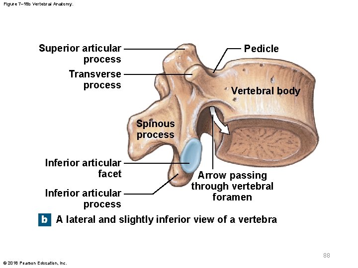 Figure 7– 18 b Vertebral Anatomy. Superior articular process Pedicle Transverse process Vertebral body