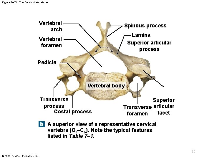 Figure 7– 19 b The Cervical Vertebrae. Vertebral arch Spinous process Lamina Superior articular