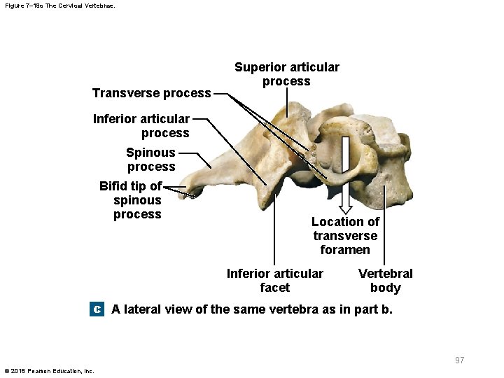Figure 7– 19 c The Cervical Vertebrae. Transverse process Superior articular process Inferior articular