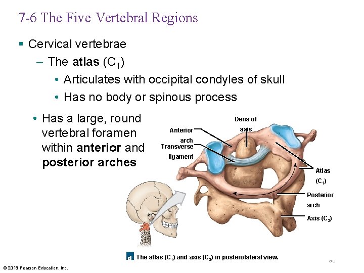 7 -6 The Five Vertebral Regions § Cervical vertebrae – The atlas (C 1)