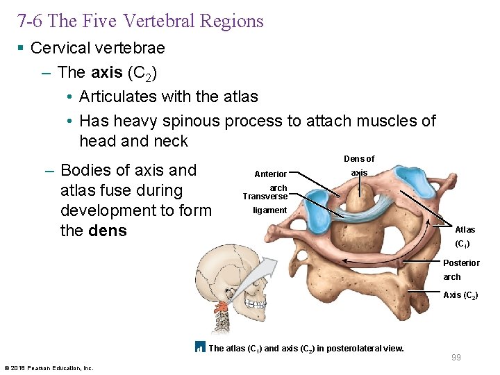 7 -6 The Five Vertebral Regions § Cervical vertebrae – The axis (C 2)