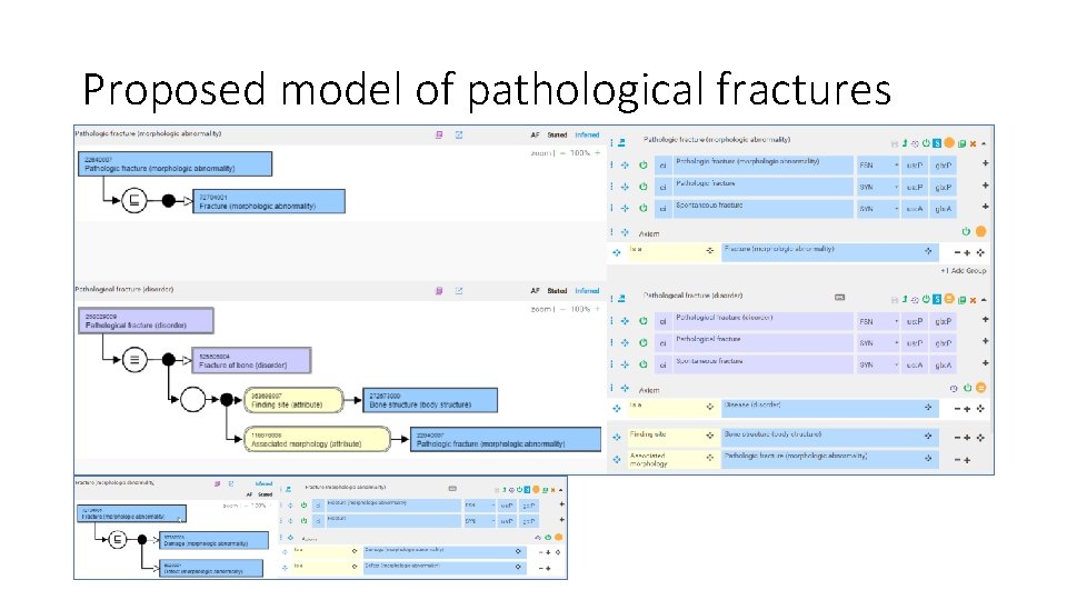Proposed model of pathological fractures Proposed model of pathological fractures