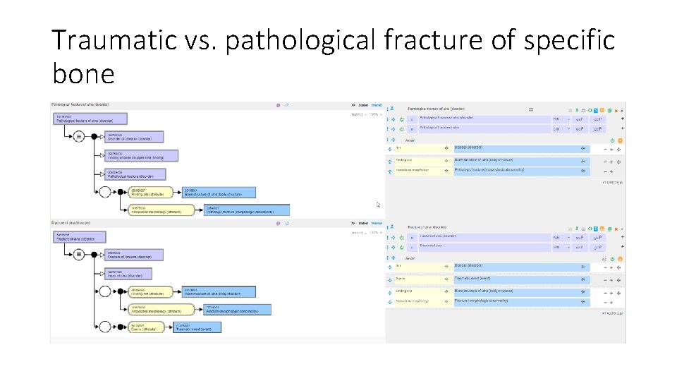 Traumatic vs. pathological fracture of specific bone Traumatic vs. pathological fracture of specific bone