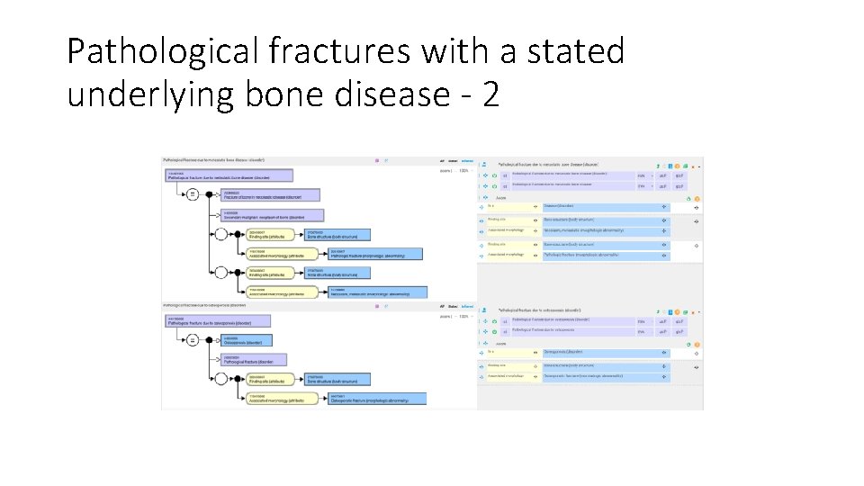 Pathological fractures with a stated underlying bone disease - 2 Pathological fractures with a stated underlying bone disease - 2