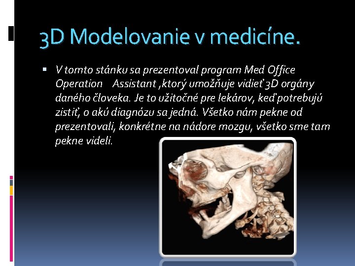 3 D Modelovanie v medicíne. V tomto stánku sa prezentoval program Med Office Operation