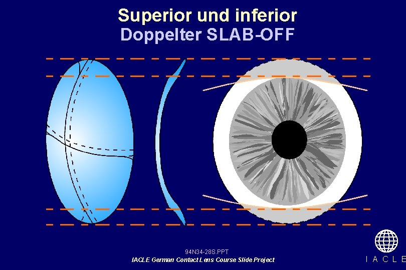 Superior und inferior Doppelter SLAB-OFF 94 N 34 -28 S. PPT IACLE German Contact