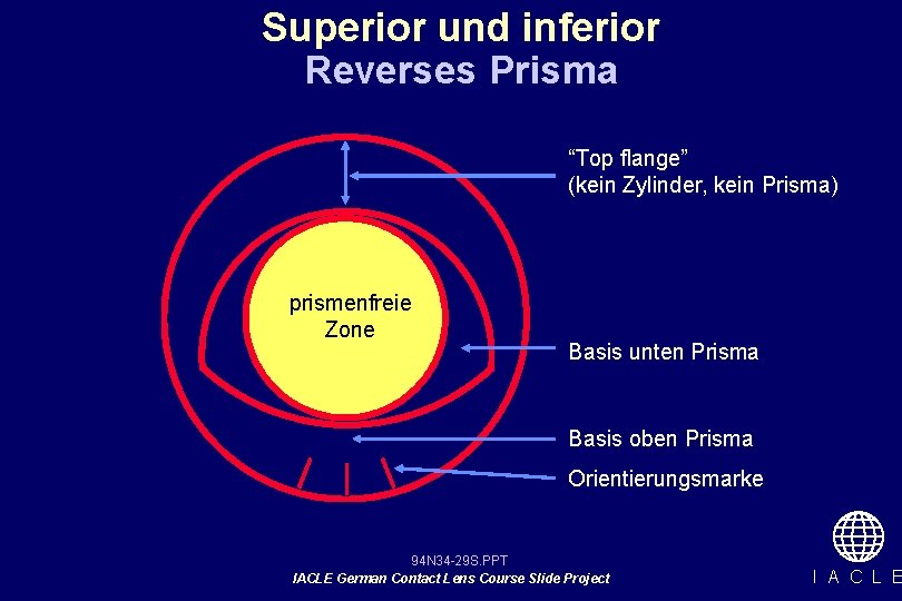 Superior und inferior Reverses Prisma “Top flange” (kein Zylinder, kein Prisma) prismenfreie Zone Basis