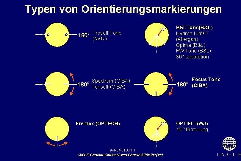 Typen von Orientierungsmarkierungen 180° Tresoft Toric 30° (N&N) Focus Toric 180° (CIBA) Spectrum (CIBA)