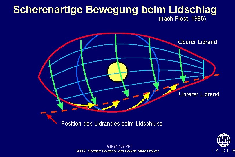 Scherenartige Bewegung beim Lidschlag (nach Frost, 1985) Oberer Lidrand Unterer Lidrand Position des Lidrandes