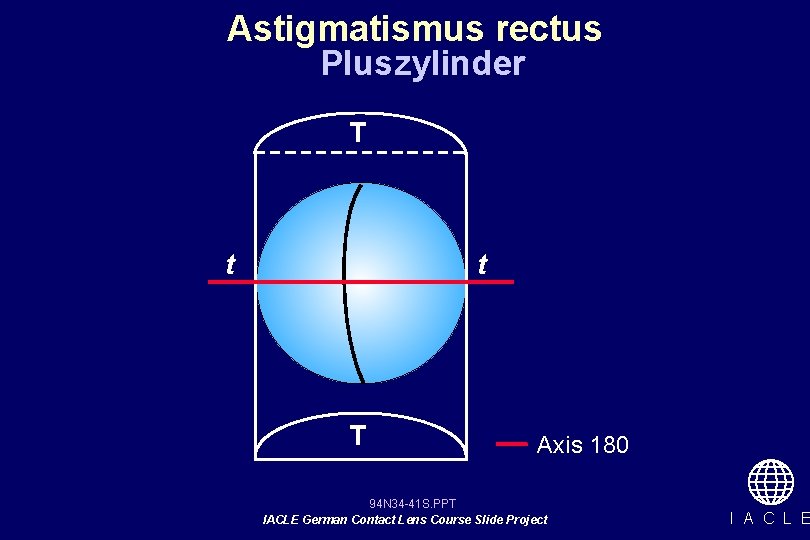 Astigmatismus rectus Pluszylinder T t t T Axis 180 94 N 34 -41 S.