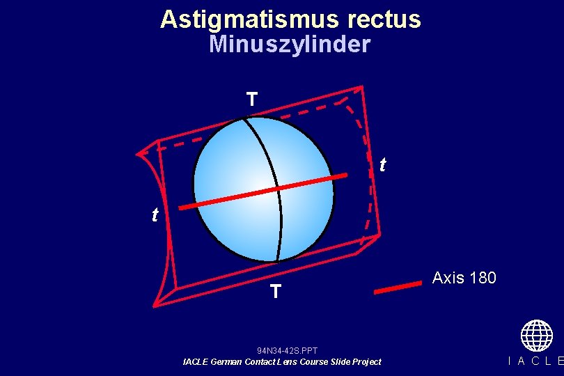 Astigmatismus rectus Minuszylinder T t t T 94 N 34 -42 S. PPT IACLE