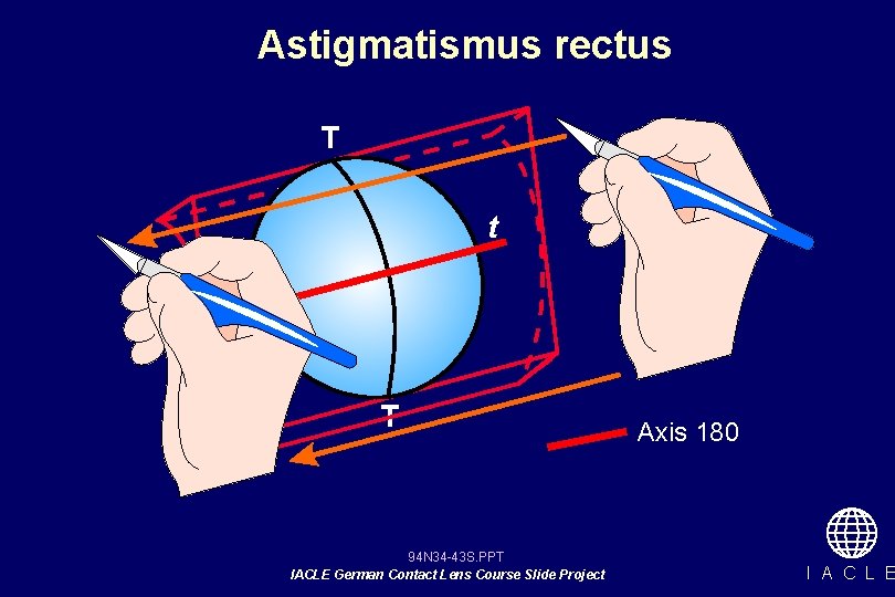 Astigmatismus rectus T t T 94 N 34 -43 S. PPT IACLE German Contact