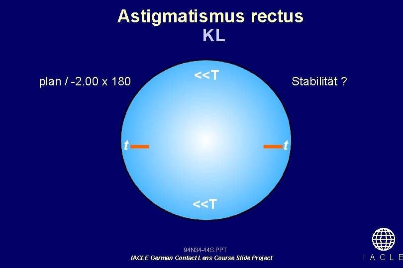 Astigmatismus rectus KL plan / -2. 00 x 180 <<T t Stabilität ? t