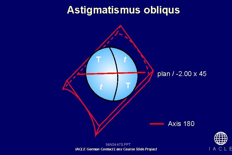 Astigmatismus obliqus T t plan / -2. 00 x 45 t T Axis 180