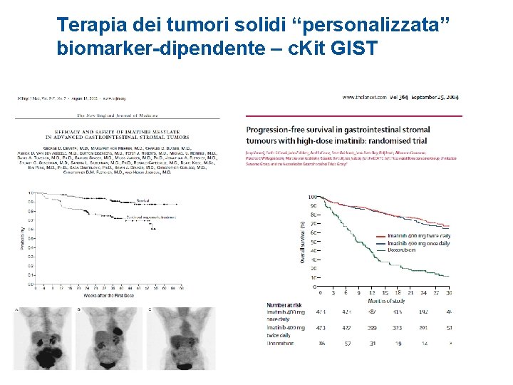 Terapia dei tumori solidi “personalizzata” biomarker-dipendente – c. Kit GIST HER 2+ 20% HER