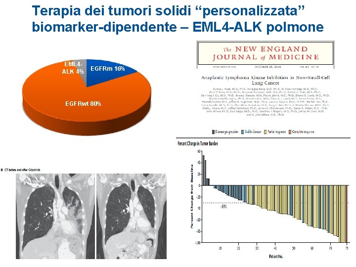 Terapia dei tumori solidi “personalizzata” biomarker-dipendente – EML 4 -ALK polmone EML 4 ALK