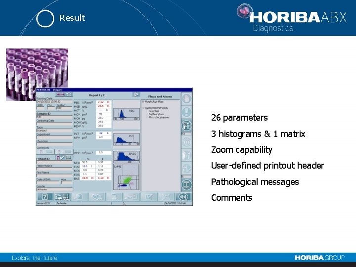 Result 26 parameters 3 histograms & 1 matrix Zoom capability User-defined printout header Pathological