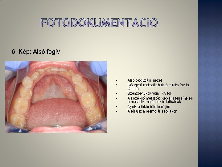 6. Kép: Alsó fogív • • • Alsó okkluzális nézet Középső metszők bukkális felszíne