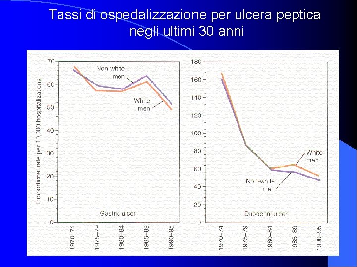 Tassi di ospedalizzazione per ulcera peptica negli ultimi 30 anni 