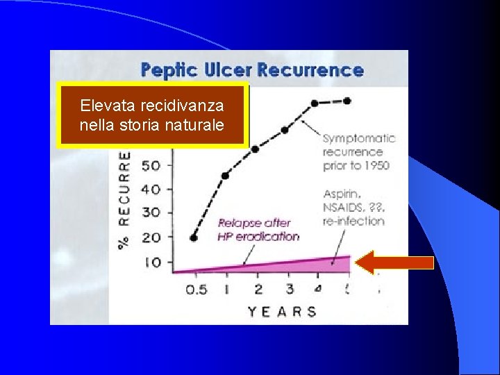 Elevata recidivanza nella storia naturale 