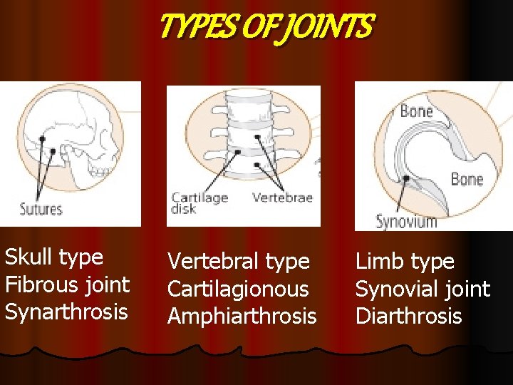 TYPES OF JOINTS Skull type Fibrous joint Synarthrosis Vertebral type Cartilagionous Amphiarthrosis Limb type