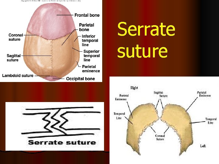 Serrate suture 