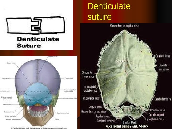 Denticulate suture 