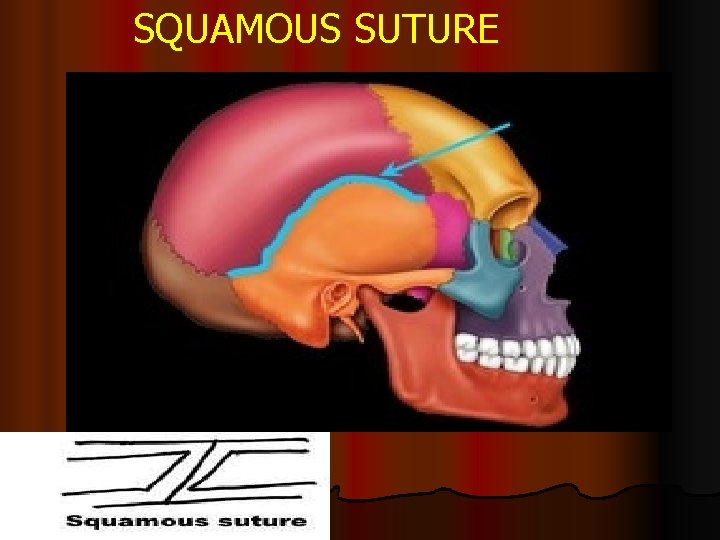 SQUAMOUS SUTURE 