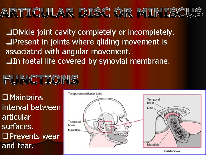 ARTICULAR DISC OR MINISCUS q. Divide joint cavity completely or incompletely. q. Present in