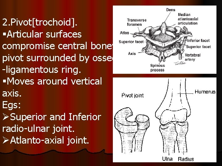 2. Pivot[trochoid]. §Articular surfaces compromise central boney pivot surrounded by osseo -ligamentous ring. §Moves