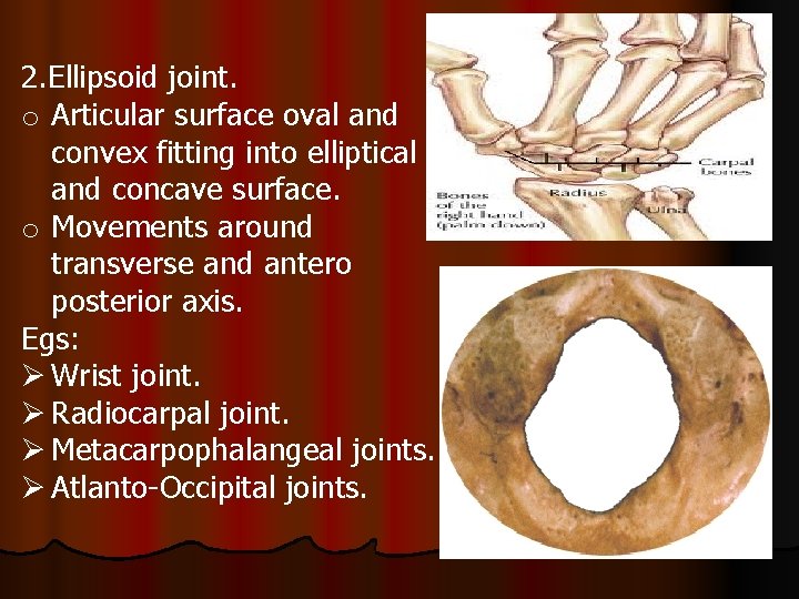 2. Ellipsoid joint. o Articular surface oval and convex fitting into elliptical and concave