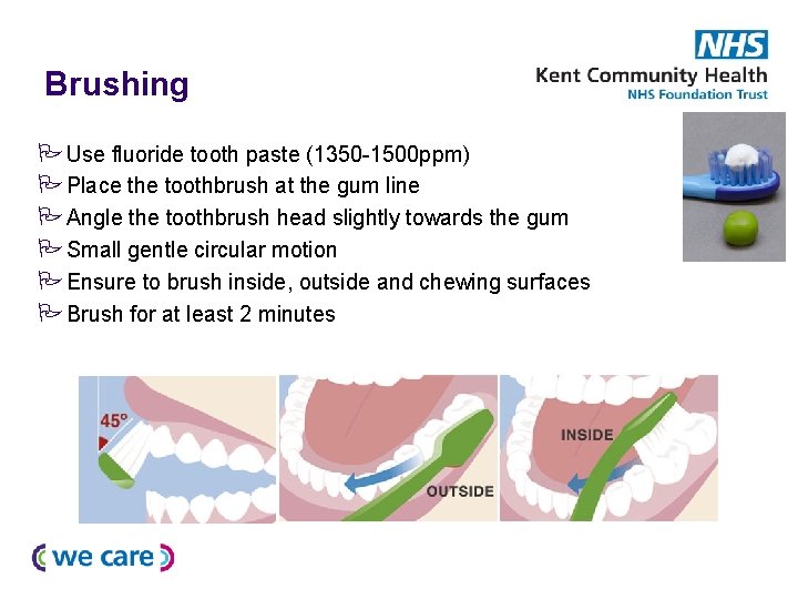 Brushing Use fluoride tooth paste (1350 -1500 ppm) Place the toothbrush at the gum