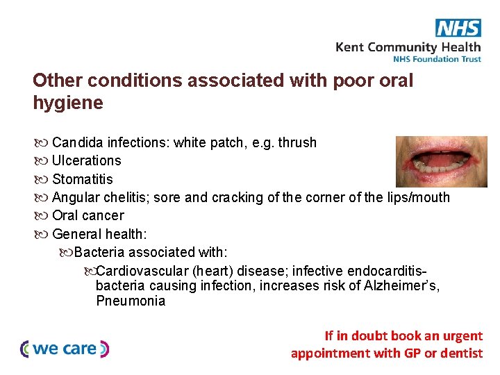 Other conditions associated with poor oral hygiene Candida infections: white patch, e. g. thrush