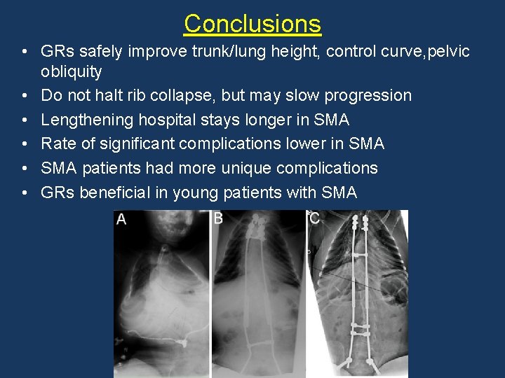 Conclusions • GRs safely improve trunk/lung height, control curve, pelvic obliquity • Do not Conclusions • GRs safely improve trunk/lung height, control curve, pelvic obliquity • Do not