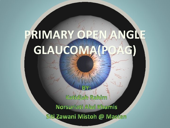 PRIMARY OPEN ANGLE GLAUCOMA(POAG) 