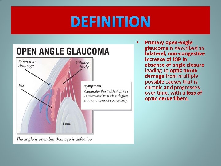 DEFINITION • Primary open-angle glaucoma is described as bilateral, non-congestive increase of IOP in