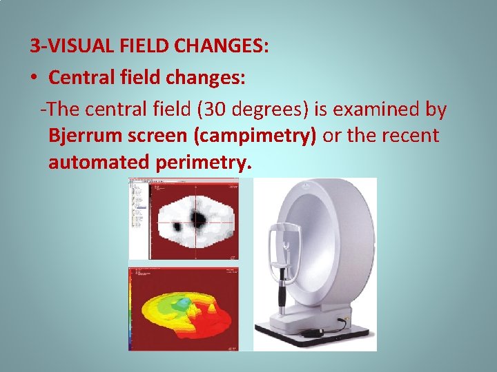 3 -VISUAL FIELD CHANGES: • Central field changes: -The central field (30 degrees) is