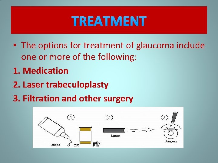 TREATMENT • The options for treatment of glaucoma include one or more of the