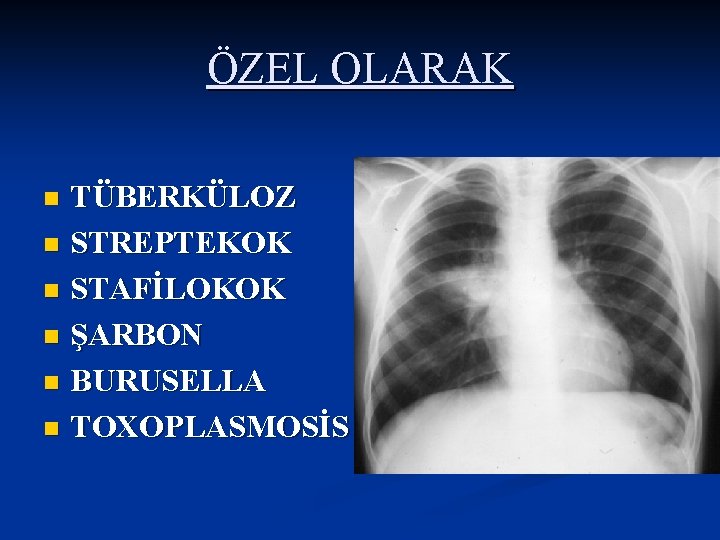 ÖZEL OLARAK TÜBERKÜLOZ n STREPTEKOK n STAFİLOKOK n ŞARBON n BURUSELLA n TOXOPLASMOSİS n