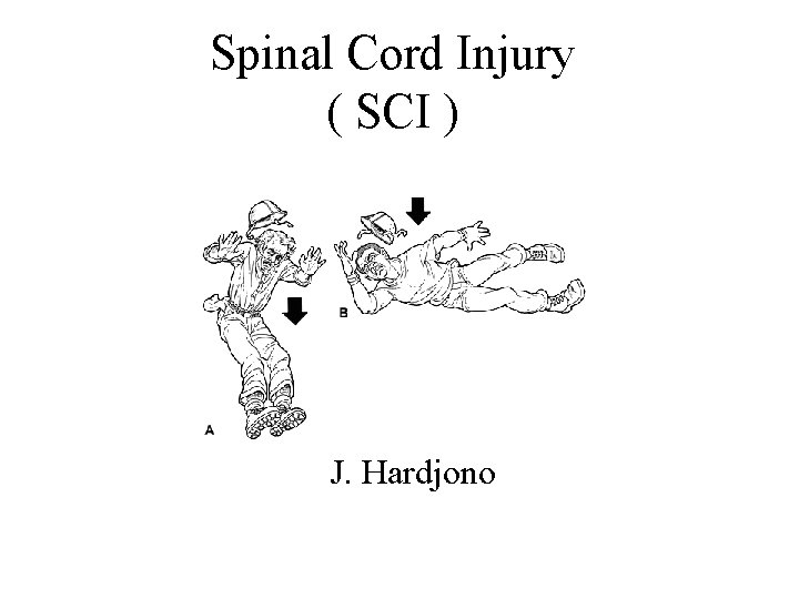 Spinal Cord Injury ( SCI ) J. Hardjono 