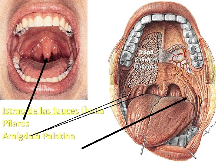 Glánd. Salivares Palatinas Istmo de las fauces Úvula Pilares Amígdala Palatina 