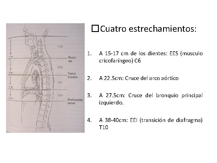 �Cuatro estrechamientos: 1. A 15 -17 cm de los dientes: EES (musculo cricofaríngeo) C �Cuatro estrechamientos: 1. A 15 -17 cm de los dientes: EES (musculo cricofaríngeo) C