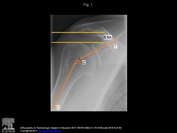 Fig. 1 Orthopaedics & Traumatology: Surgery & Research 2017 103415 -420 DOI: (10. 1016/j.